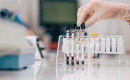 Interpretação de Exames Laboratoriais para Acadêmicos e Profissionais da Saúde